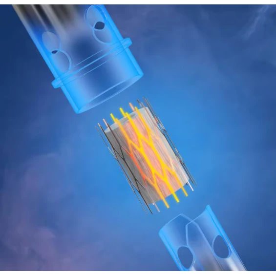Aspire Vilter Fun